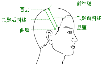 「中医适宜技术」第一篇 针刺技术｜第2章头针技术