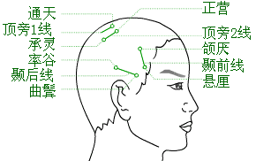 「中医适宜技术」第一篇 针刺技术｜第2章头针技术