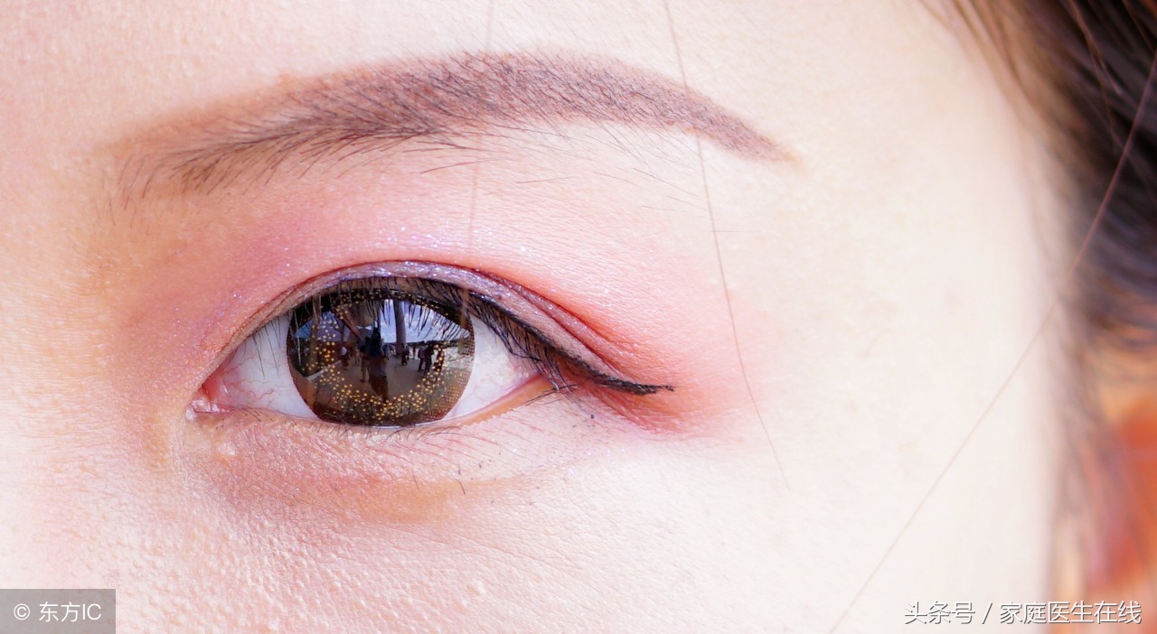 眼睛总是出现红血丝？5个方法，能大大缓解这个顽固问题！