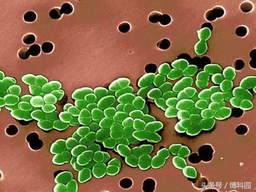 光敏细菌诱饵有助于对抗耐甲氧西林金黄色葡萄球菌感染