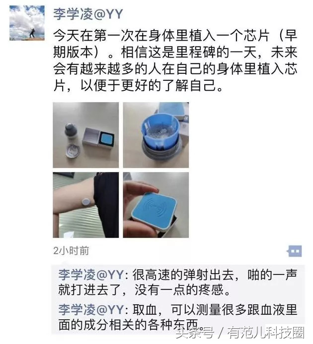 瑞典4000人身体被植入芯片，人工智能到底能带来