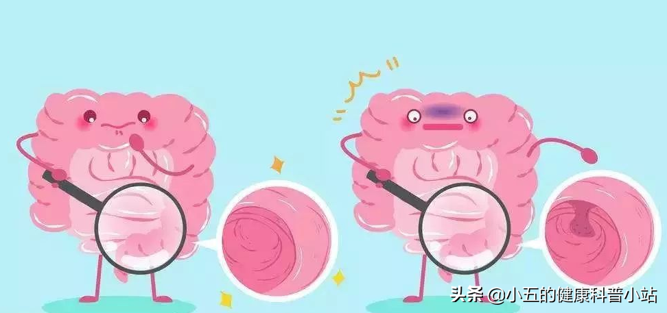 肠润茶、清肠茶真的可以常喝吗？不，含有这些中药成分的不能常喝