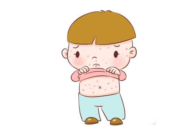 宝宝脸上常出现的小红点是什么？教你快速分辨8种红疹症状