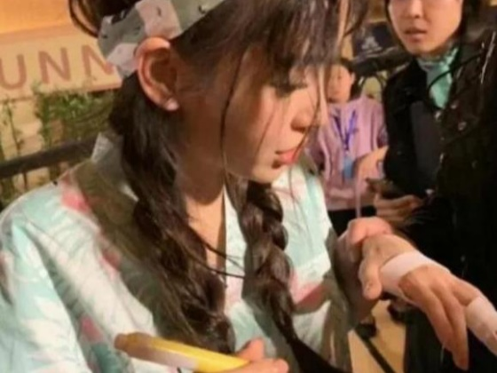 都以为综艺赚钱快又轻松，但明星受伤可不在少