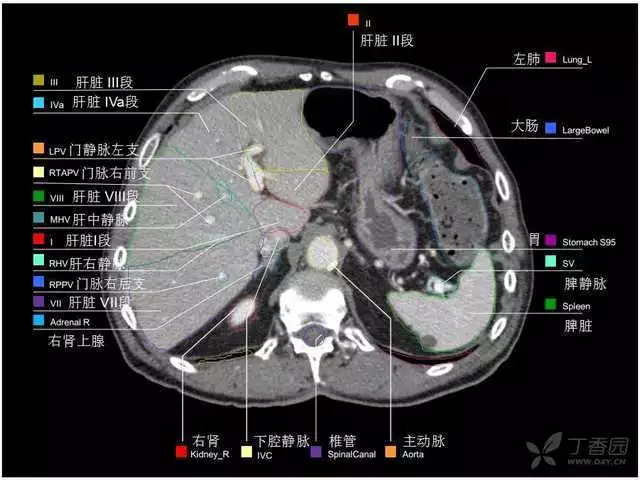 掌握这篇解剖，晋级腹部CT影像诊断高手（精细版）