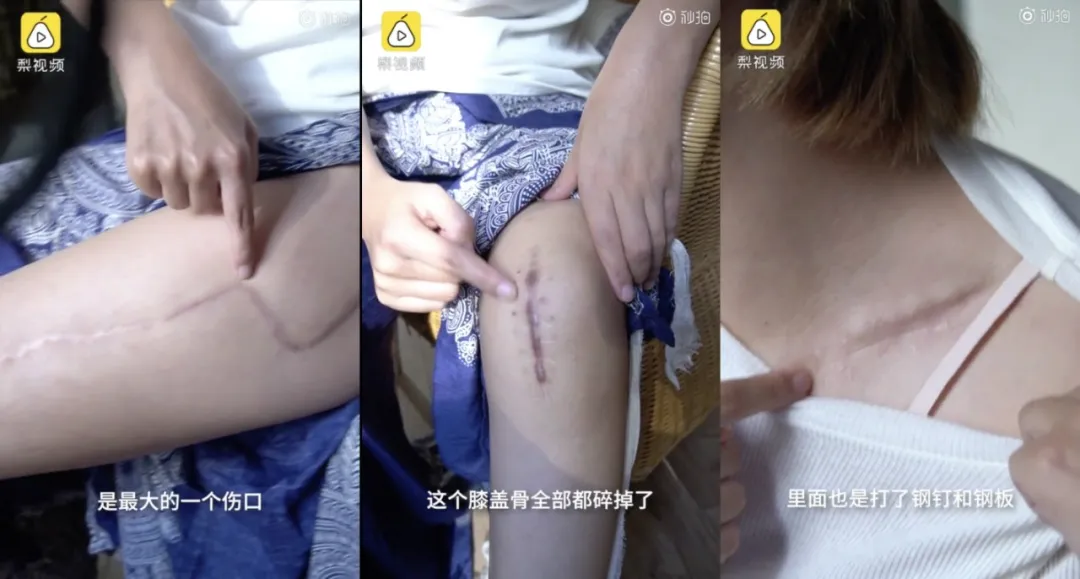 孕妇坠崖451天后：“为了要我的命，他从开始就计划好了一切”