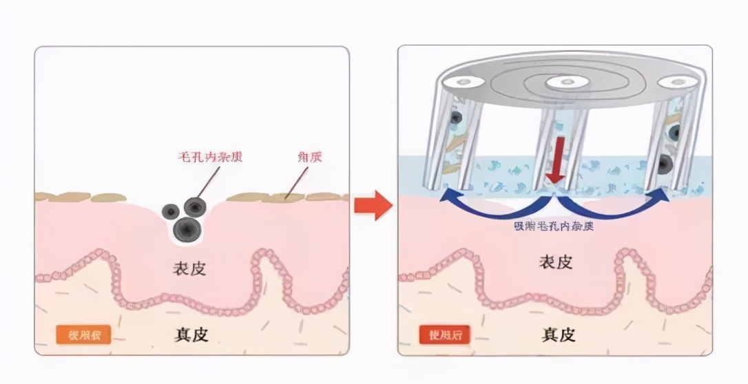 素颜美肌？从皮肤清洁开始