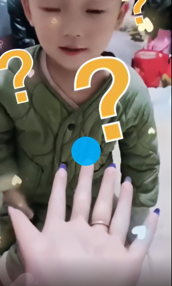 「12根」女子天生12根手指自嘲六指琴魔 心态乐观自侃做美甲费钱