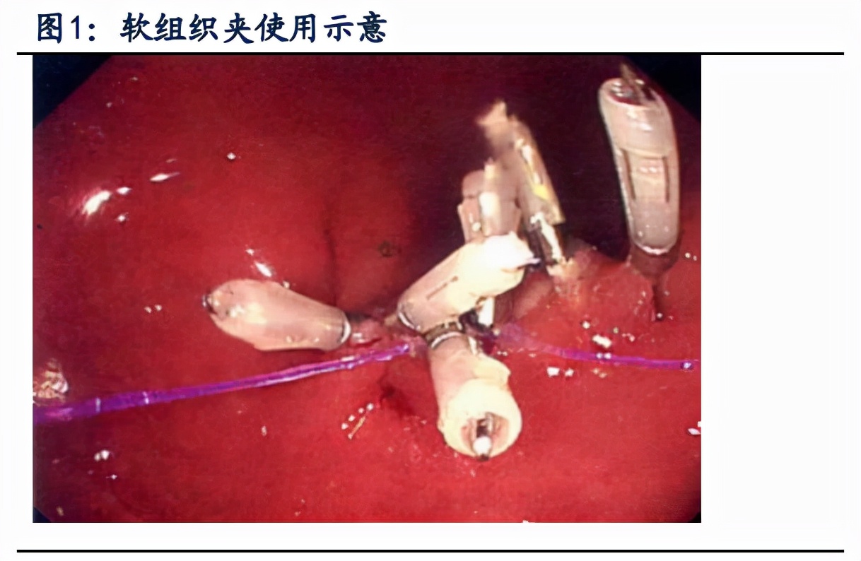 南微医学专题研究：另辟蹊径，成就消化内镜领军企业