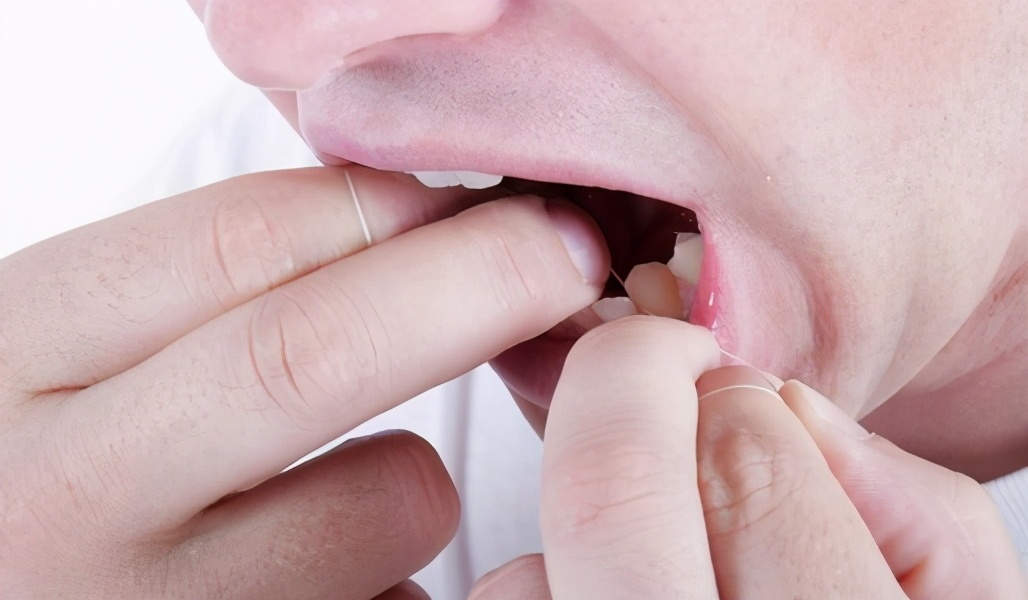 晨起後口氣惡臭難聞？ 營養師：學會吃這4類食物，沒有社交恐懼症