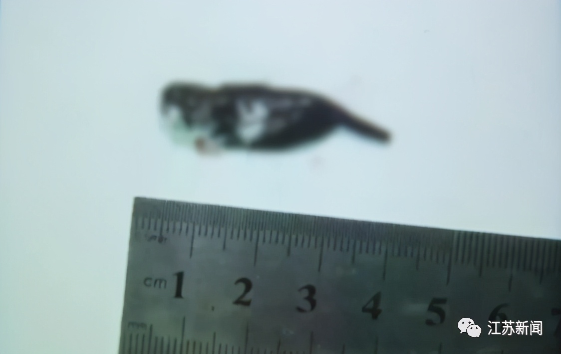 女子喉嚨中取出 5 厘米長(zhǎng)的螞蟥，只因喝了這種水