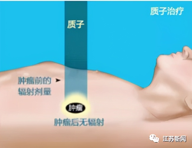 放疗■得了癌症不能吃发物？放疗死得更快？你转发的防癌知识可能在害人