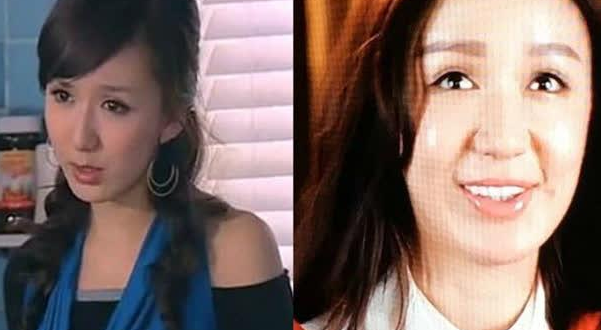 整容毀了多少童年女神，蕭薔王祖賢婁藝瀟，面目全非成毀容
