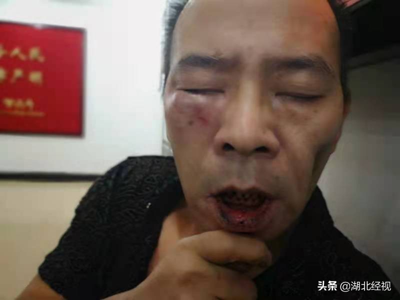 小区多名业主遭物业公司殴打警方介入调查