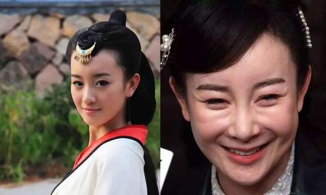 这7位女星的脸都怎么了？张檬哭诉后悔整容，薛佳凝颜值崩塌