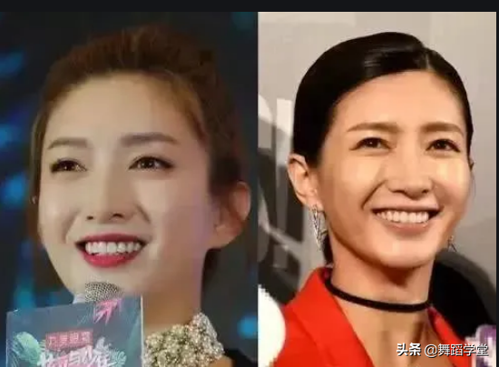 每天刷牙为啥牙齿还那么黄？坚持用它黄牙变白牙，嘴里清新没异味