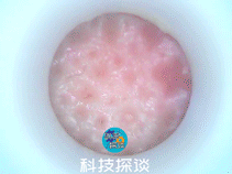 深层清洁黑头，边吸边看的inFace可视化黑头仪