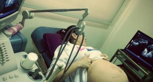 刘畊宏妻子自曝产后大出血，生三胎长九颗子宫肌瘤，无奈切除子宫