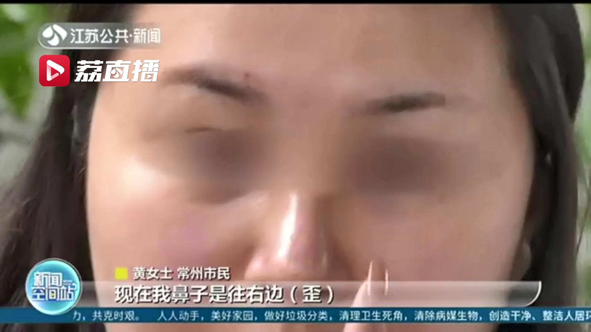 女子想要&ldquo;网红鼻&rdquo;，术后却成歪鼻子！期间医生私换假体高度还不告知&hellip;