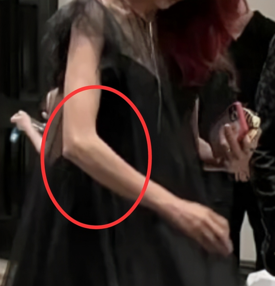 張晉夫婦被偶遇，蔡少芬瘦到胳膊骨頭凸起，下樓梯獲張晉貼心攙扶