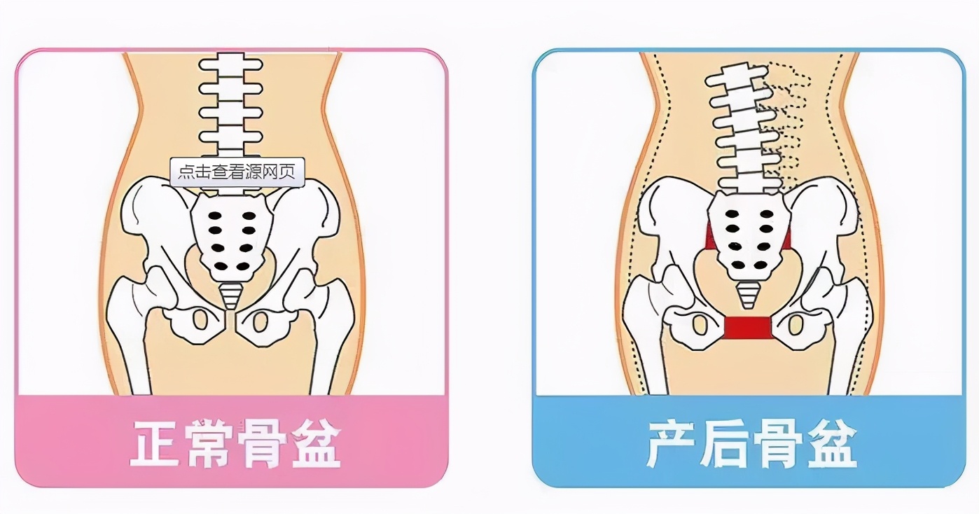 产康项目那么多，这些你绝不能错过