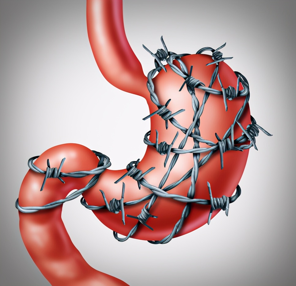 胃裡有幽門螺桿菌，嘴巴通常會發出3個信號，醫生：趁早檢查一下