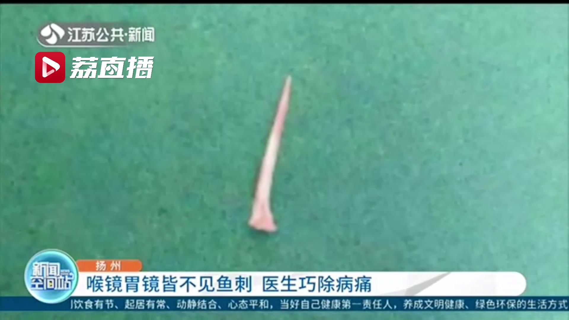 喉镜胃镜皆不见鱼刺 医生实施全麻手术进行“地毯式”排查