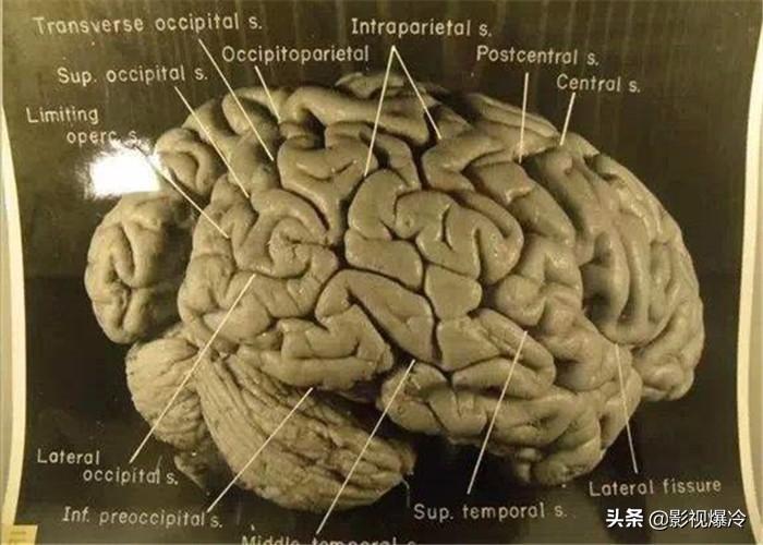 为何要保留名人器官？伽利略的手指我忍了，爱