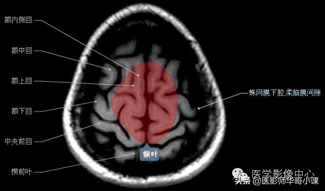 头颅磁共振（MRI）解剖--精品图集
