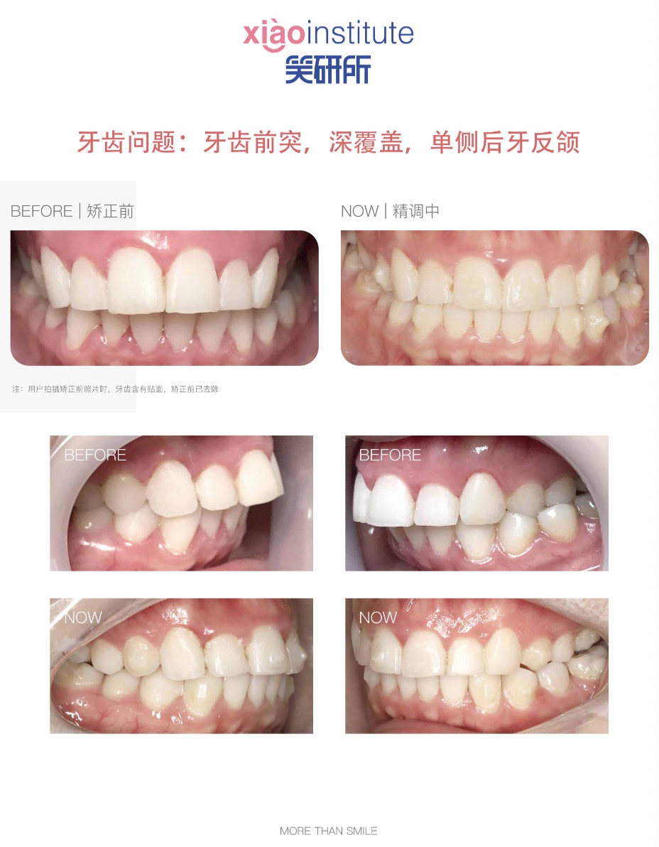 ������������ع⣺������������˵��۹����ں��ˣ���