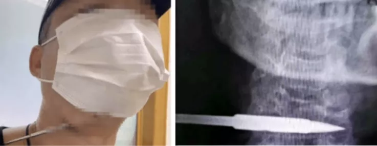 【三分钟法治新闻全知道】女子不满134元假手机配件,报警后牵出1.1亿元大案