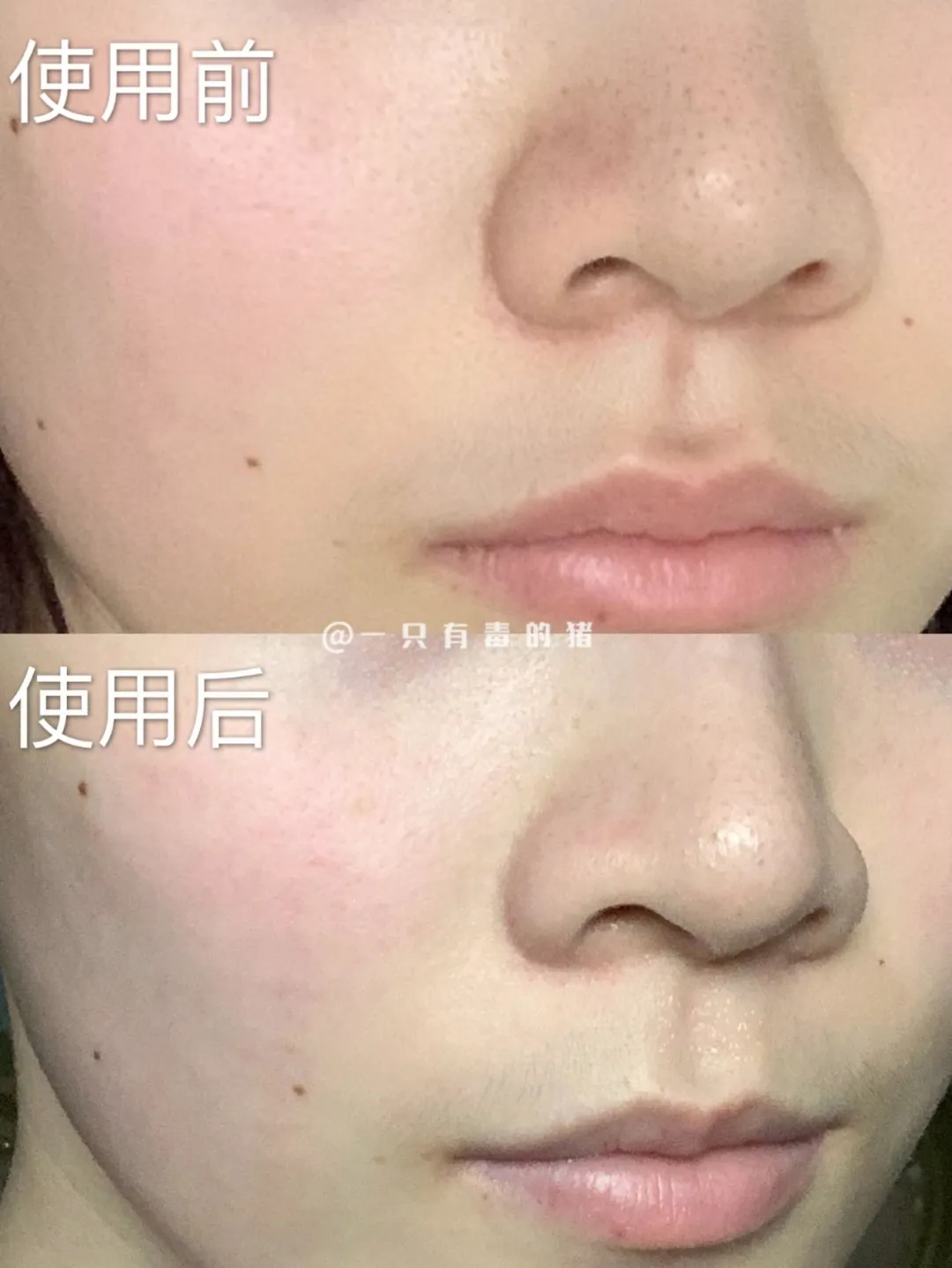 认真的吗?金晨居然用啤酒敷脸