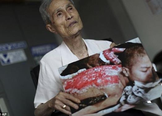 为何日本人忌惮谈起二战？核爆炸亲历者现状，