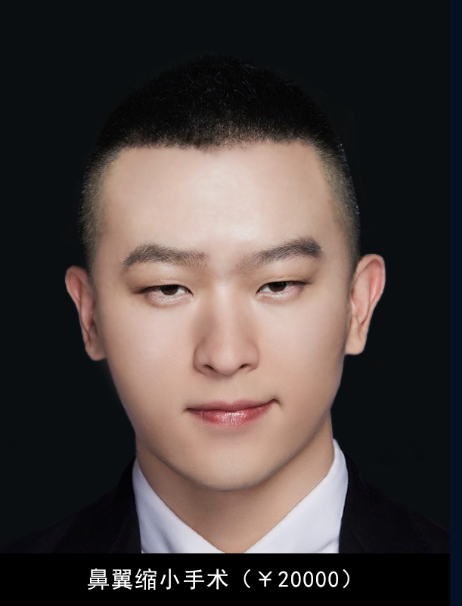 35万！岳云鹏便可整容变成邓伦，邓伦回应坚持梦