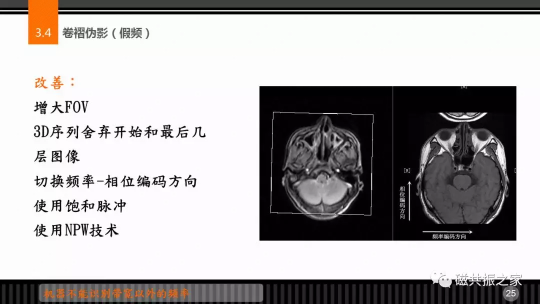 磁共振常见伪影及策略