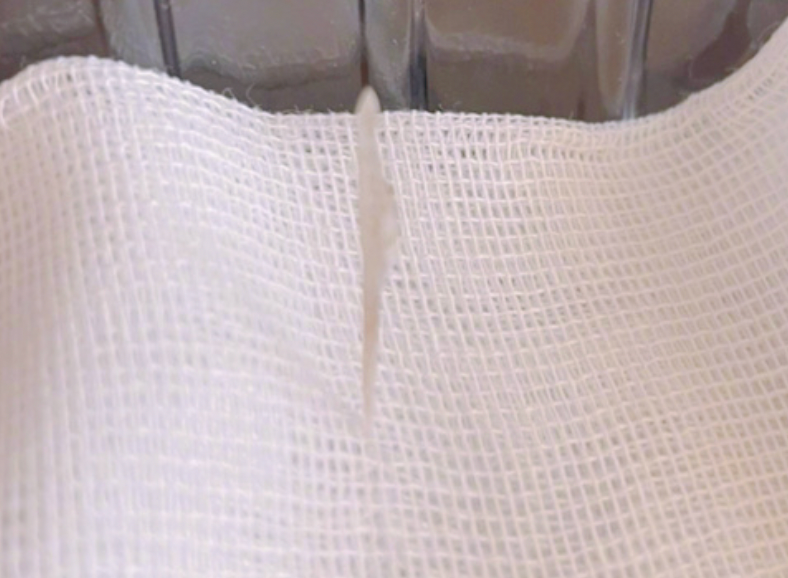 张杰深夜就医！被近3厘米鱼刺卡食道太危险，本人晒照直呼有阴影