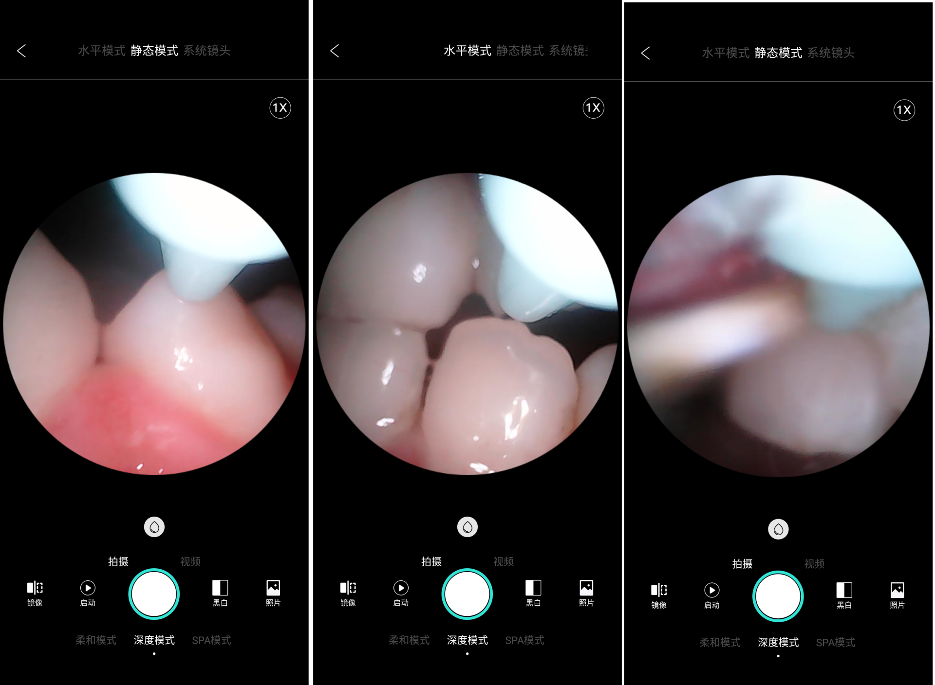 呵护一口好牙有多贵，素诺给你最想要的明眸皓齿