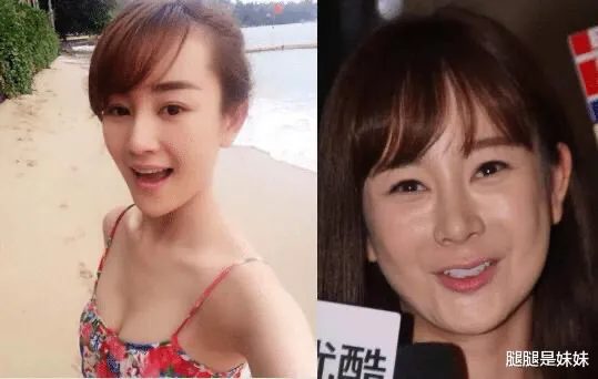 第一个微整把自己整毁的男明星,虽然很惨,可是看他就想笑