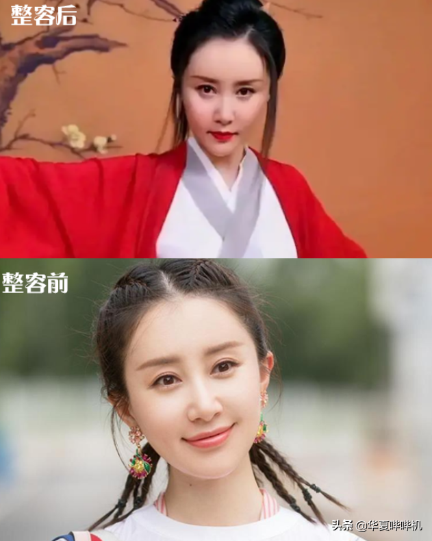 明星大型“翻车”现场，她们是如何整容变毁容