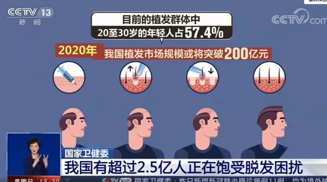 6个中国人就有1个脱发！“秃”然的惊喜：这样植发最有效！
