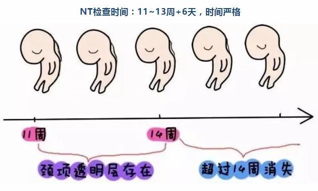 什么是NT检查，NT检查的最佳时间是怀孕多少周？