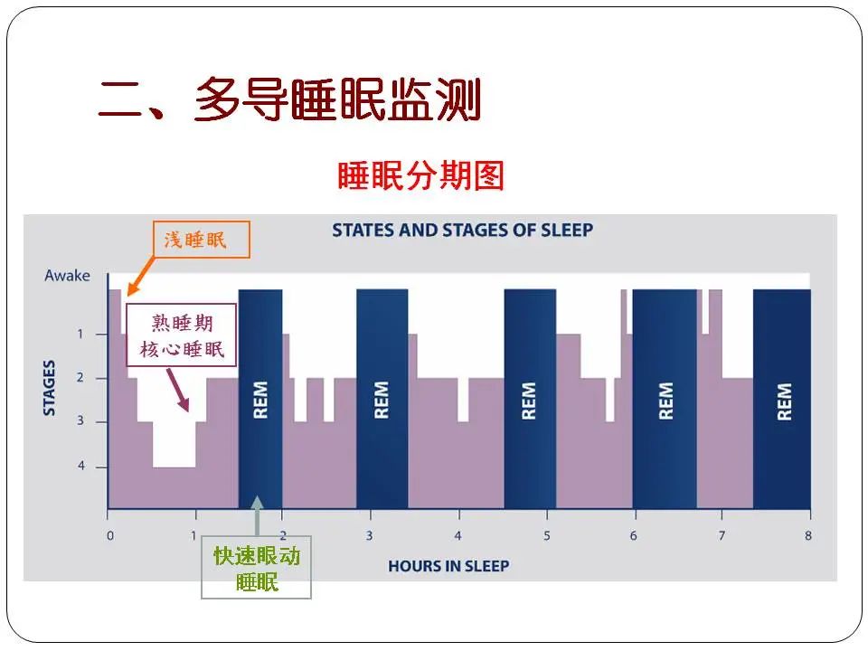 “睡眠呼吸暂停与心血管风险”健康大课堂