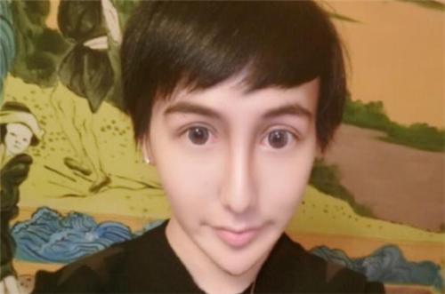蛇精臉 劉梓晨患新冠肺炎 自曝剛剛痊癒 出鏡後網友直呼辣眼 最新娛樂燴 Mdeditor