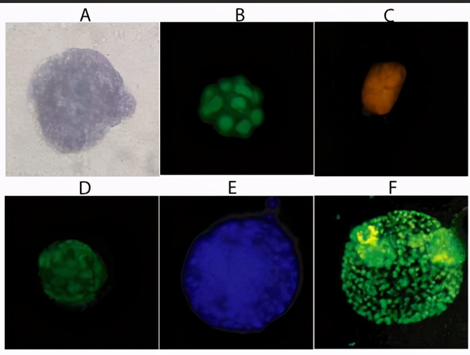 肿瘤，可以培养的比恐龙还大吗？