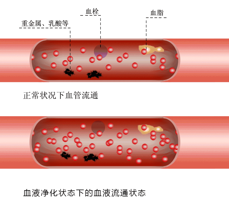 得了脂肪肝，你还在盲目运动？这4类人小心加重病情
