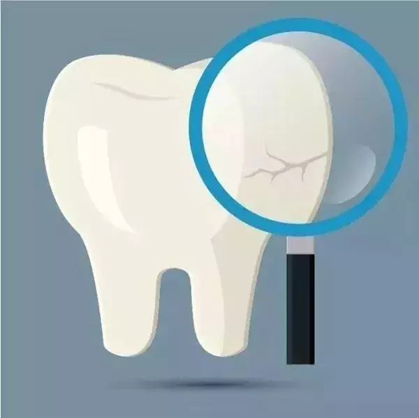 牙齿隐裂会不会自愈？听完专家的解释，你懂了吗？