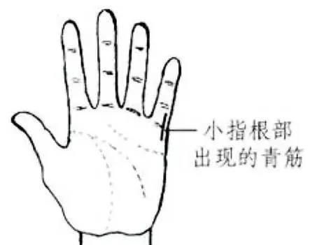 手诊手上的每一条青筋都代表不同常见病详细图解一看就明白