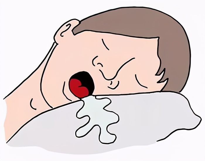 睡覺時有這些異常，或是腦血管堵塞嚴重，預防腦梗，牢記4字