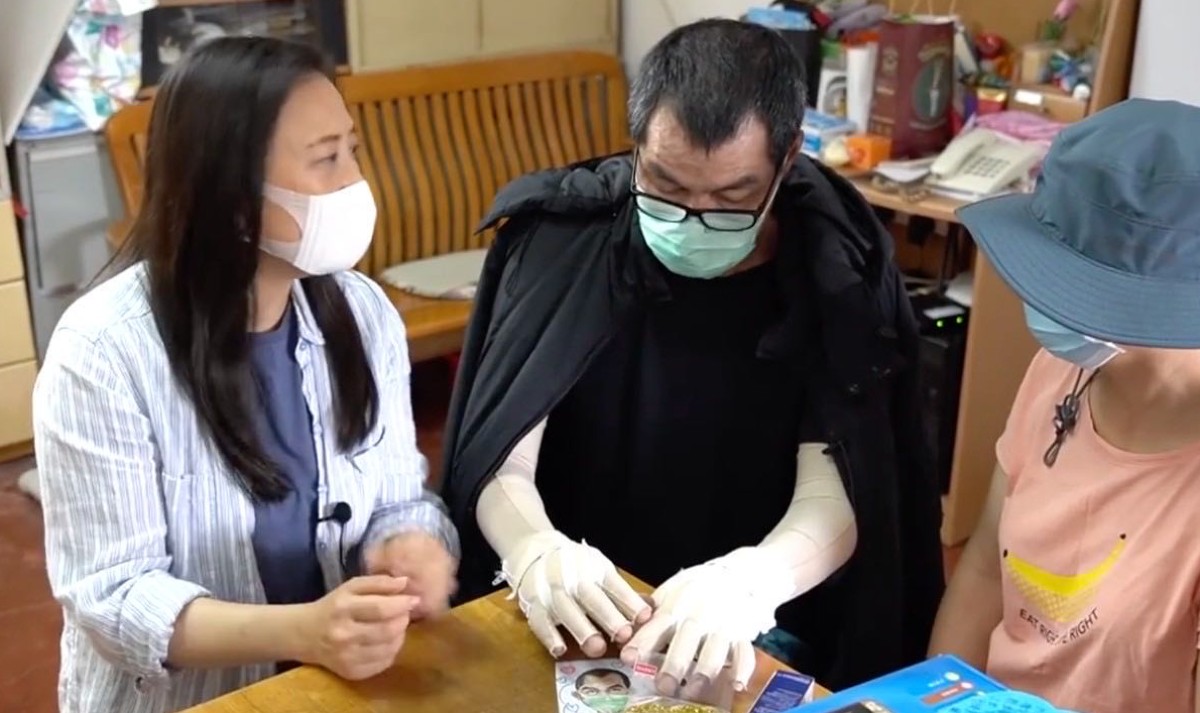 乱港|香港被烧伤的李伯将做第六次植皮手术，凶手仍逍遥法外！