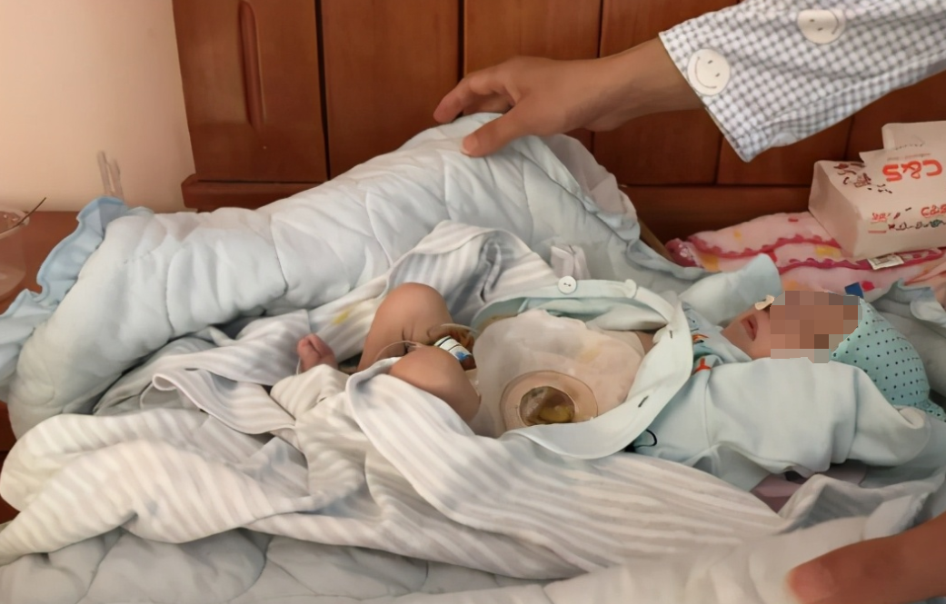 广西一男婴出生第三天被发现没有肛门，16天后因病离世，疑似院方责任